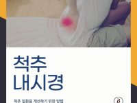 양방향 척추내시경 서울본브릿지병원